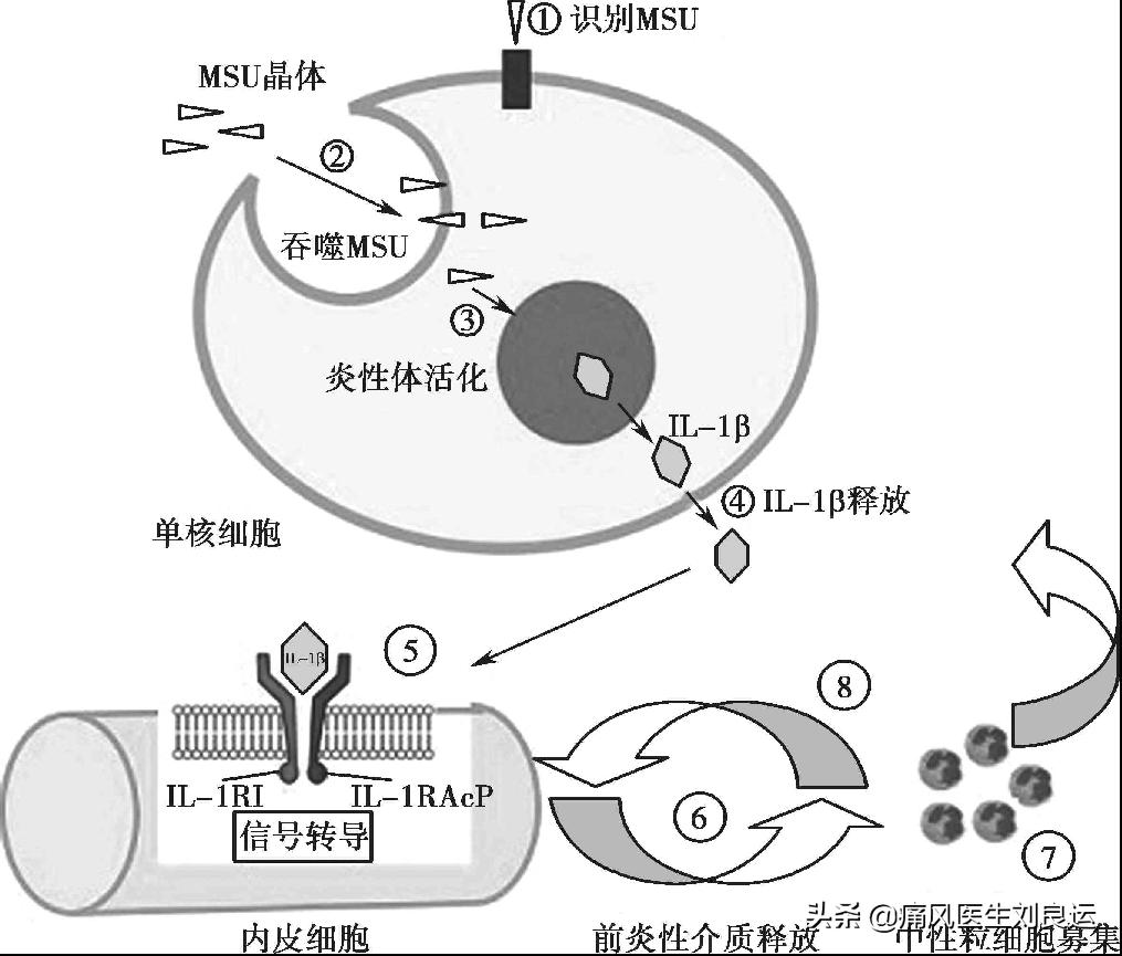 脚痛不知道是不是痛风,脚很痛不知道是痛风还是脚筋痛