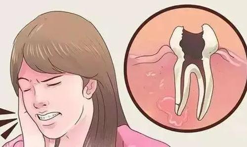 牙疼是什么原因引起的有啥偏方,牙疼小妙招真的有效果吗