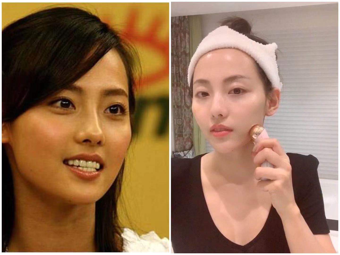 明星都是用什么牌子的美容仪,半个娱乐圈都用美容仪吗