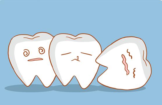 洁牙去牙垢用什么牙膏,哪种牙膏去牙垢和防蛀牙最好