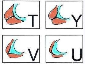 宫颈口太松需要治疗吗,宫颈松能自行恢复么