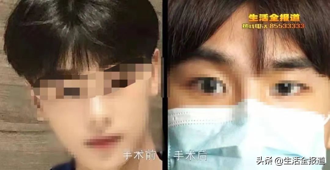 整容医院到底有多少套路?网红帅小伙在武汉一家医美整容“出事了”