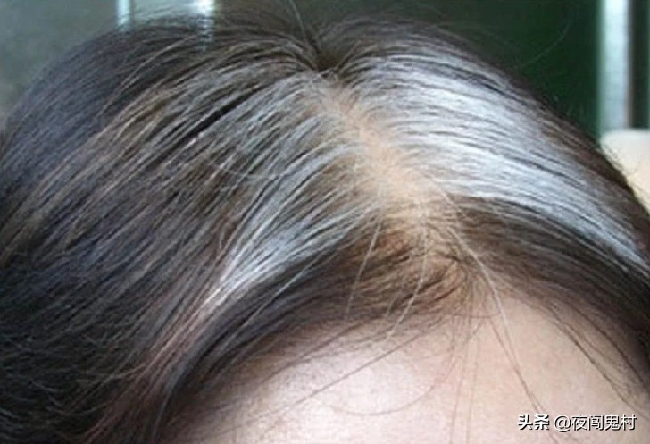 古人言白发为什么不能拔,拔头发习俗