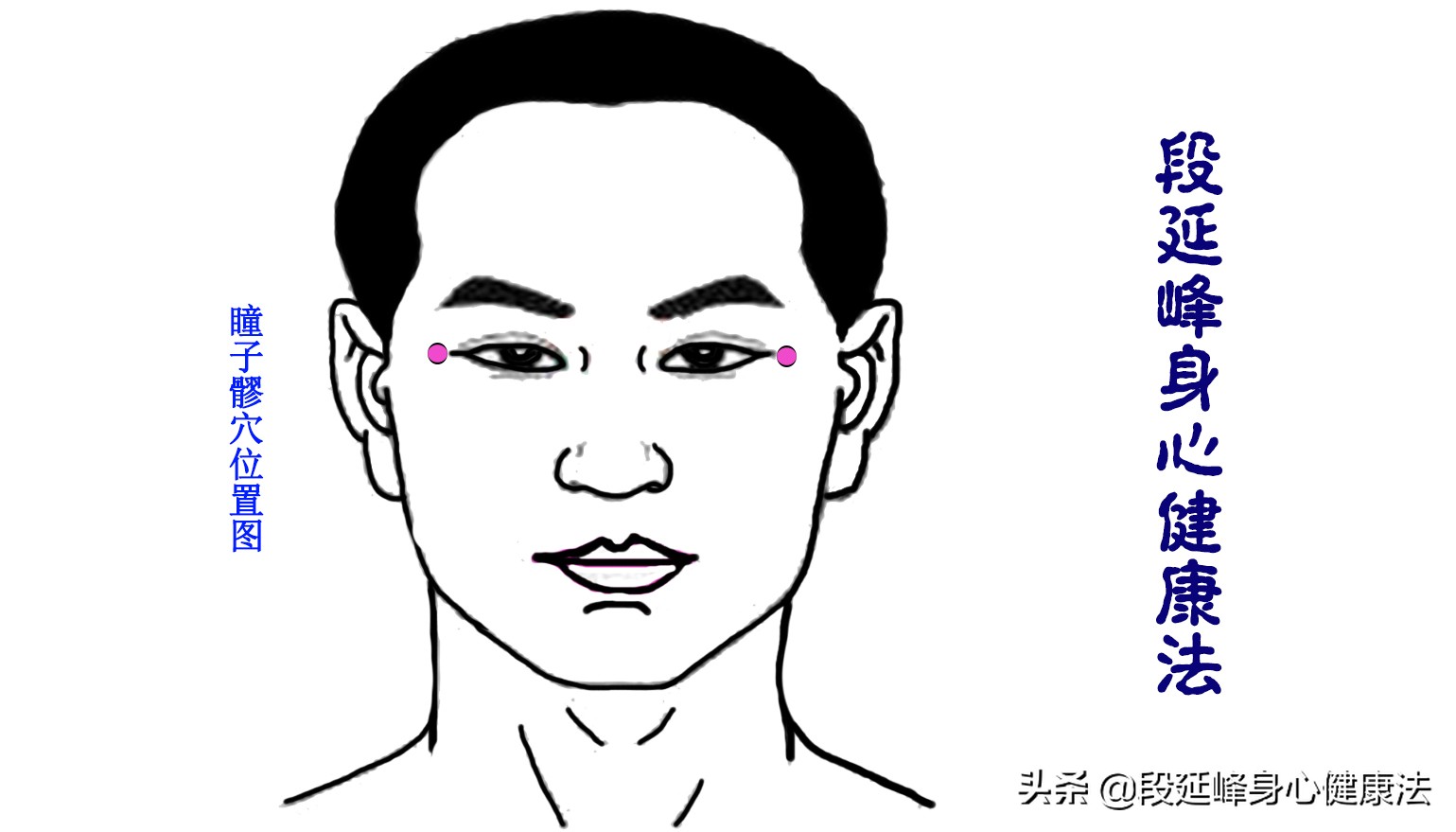 严重黑眼圈可以逆转吗,延峰治疗黑眼圈