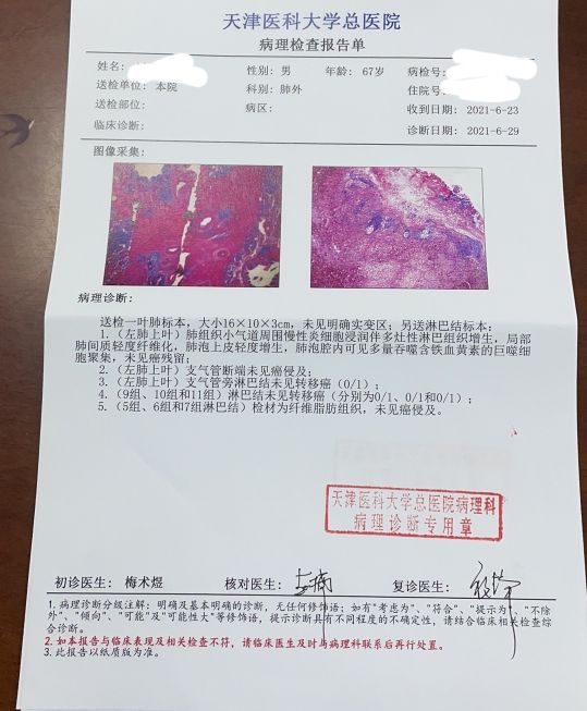 刘懿谈肺癌治愈率,刘懿谈肺癌病理报告