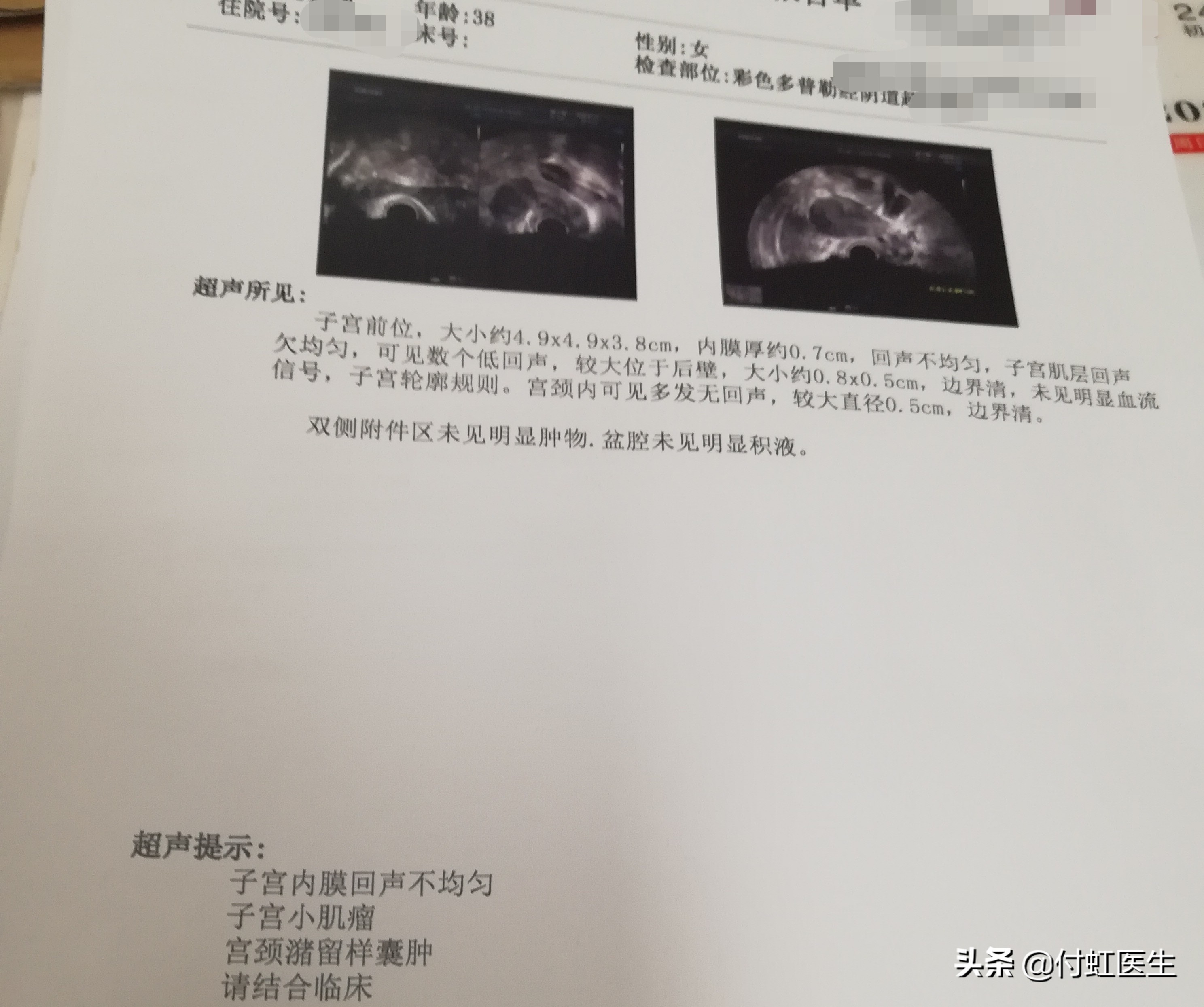 月经量突然减少是绝经的前兆吗,38岁月经量减少明显正常吗