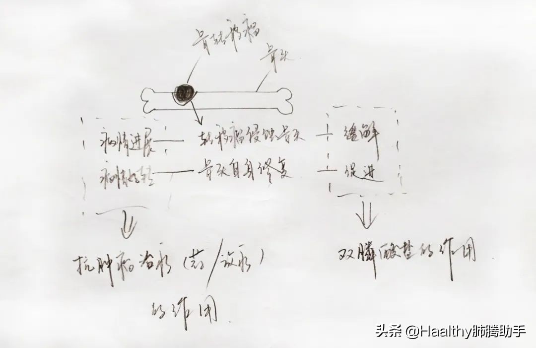 肺癌脑转移六七处,如何确认肺癌骨转移