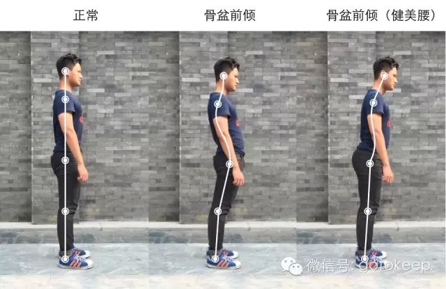 5个少儿常见不良体态，家长不重视影响深远