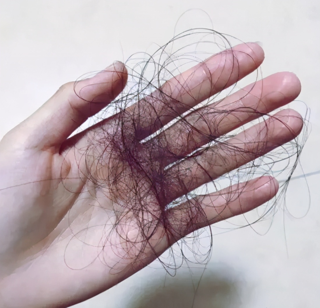 想要头发浓密植发,想要头发茂盛