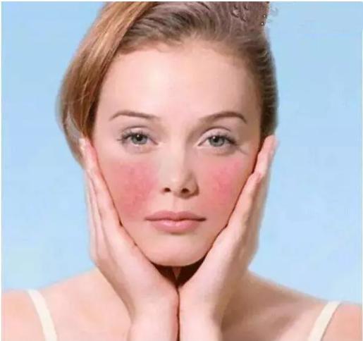 皮肤瘙痒过敏按揉什么穴位最好,皮肤老是瘙痒过敏是怎么回事啊