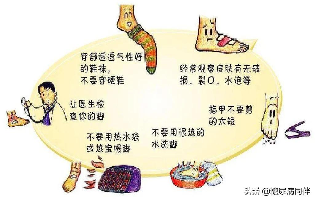 糖尿病足烂脚前有6个症状,糖尿病足早期症状如何治疗