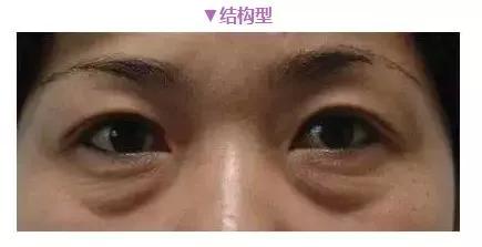 眼霜都是骗局吗视频,眼霜误区99%的人不知道