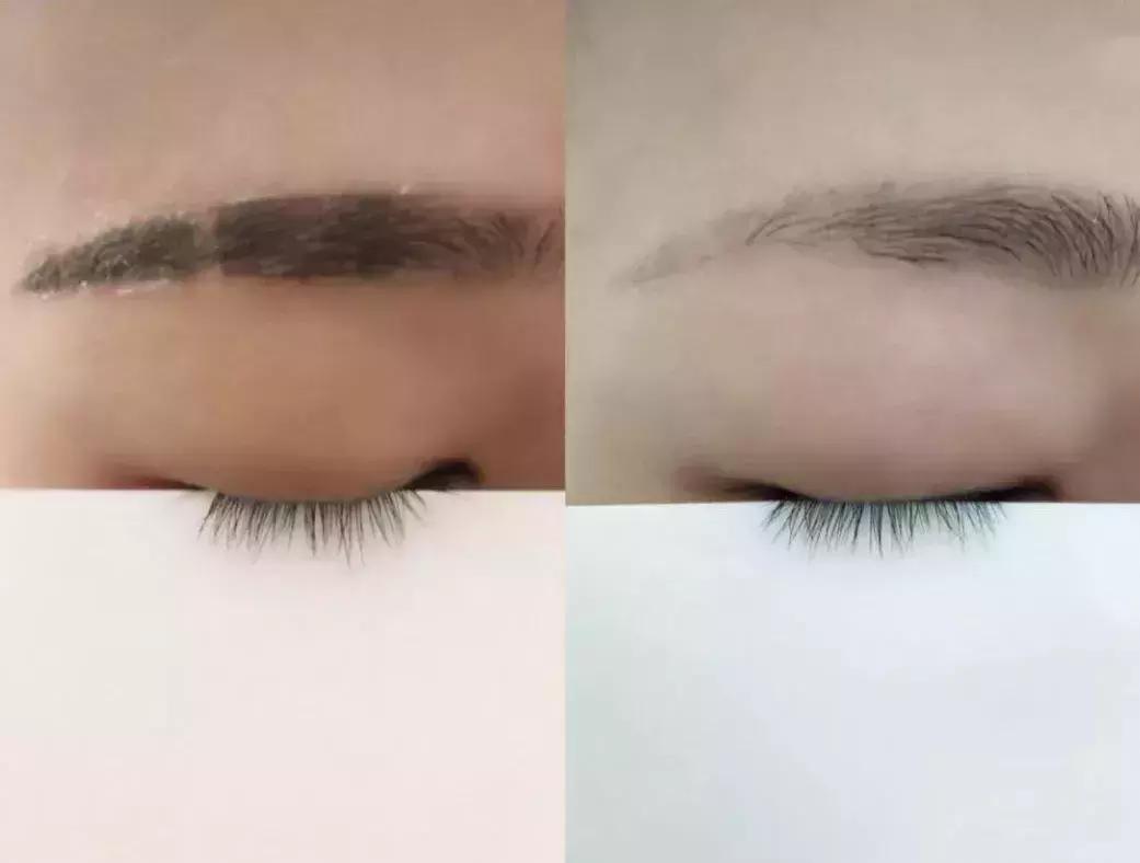 欧阳娜娜擦的药膏,欧阳娜娜擦什么药膏