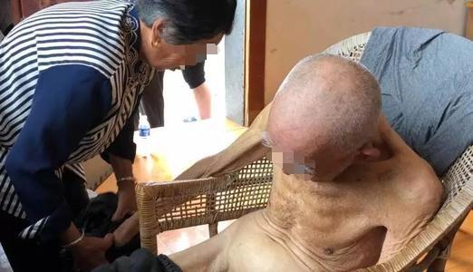 血液病引起骨折吗,哪些血液病导致骨损伤