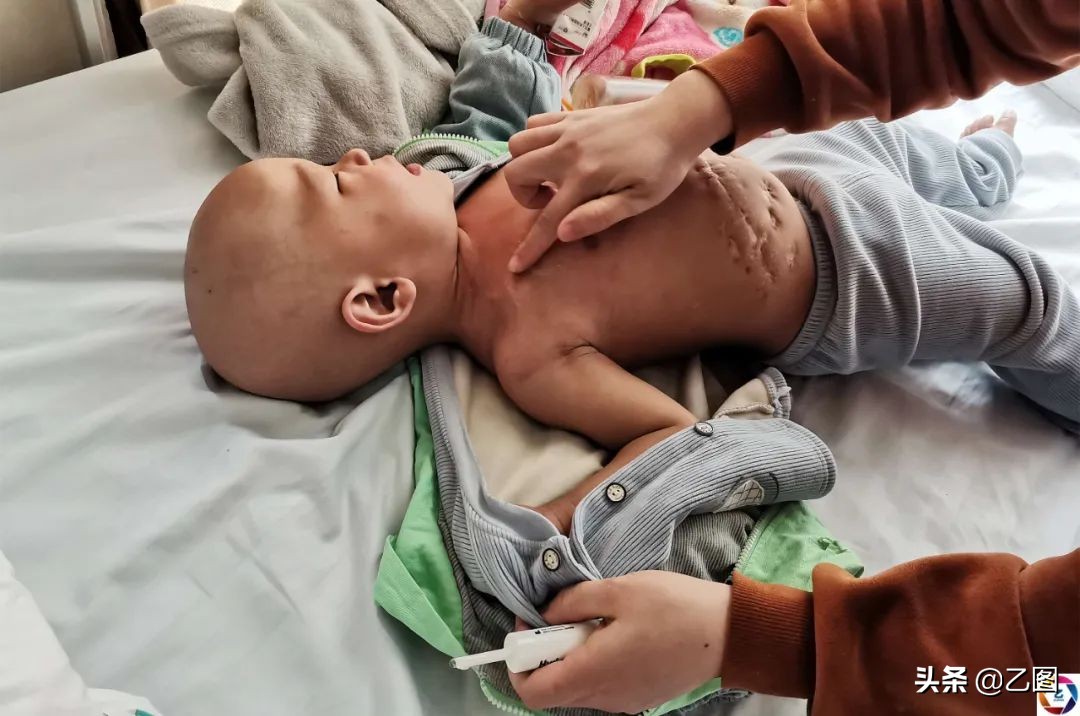 世上最悲催的婴儿,人间悲惨的孩子