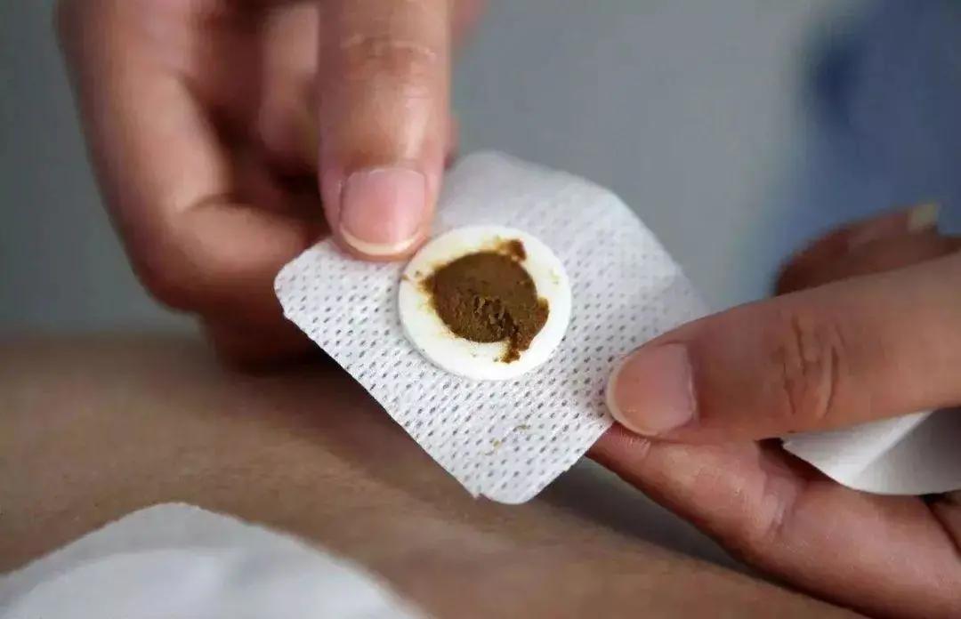 中医能治失眠焦虑症吗,中医治疗优势病种失眠