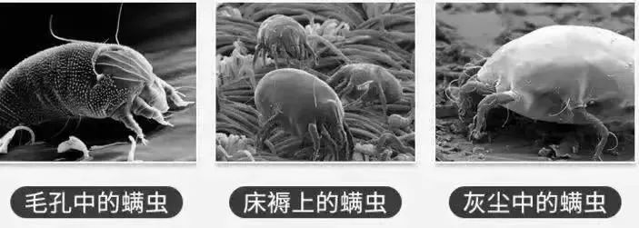 脸上螨虫多出油厉害怎么办,脸上有螨虫痘还痒该怎么办