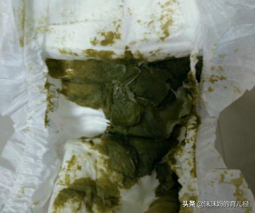 宝宝拉绿色便便还拉稀什么原因,宝宝拉绿色便便是感冒了