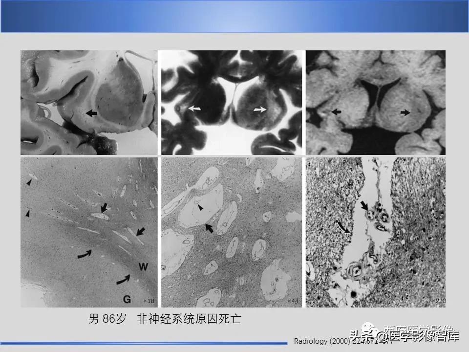 vr间隙概念,vr间隙需要做什么检查