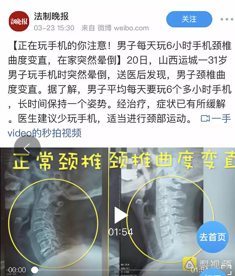 低头玩手机如何缓解颈椎,你还在侧躺玩手机吗