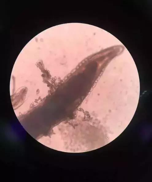 孩子屁股痒怎么止痒,孩子屁股痒的原因