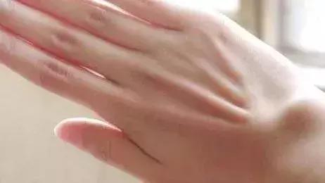 结节息肉囊肿增生哪个是癌症先兆,乙状结肠增生性的息肉会癌变吗