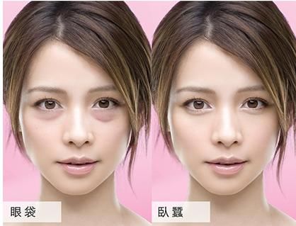 眼部常见问题有哪些,常见眼部问题