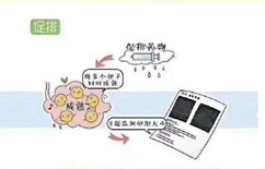 备孕小常识什么情况下需要促排卵,备孕期打促排卵针容易怀双胞胎吗