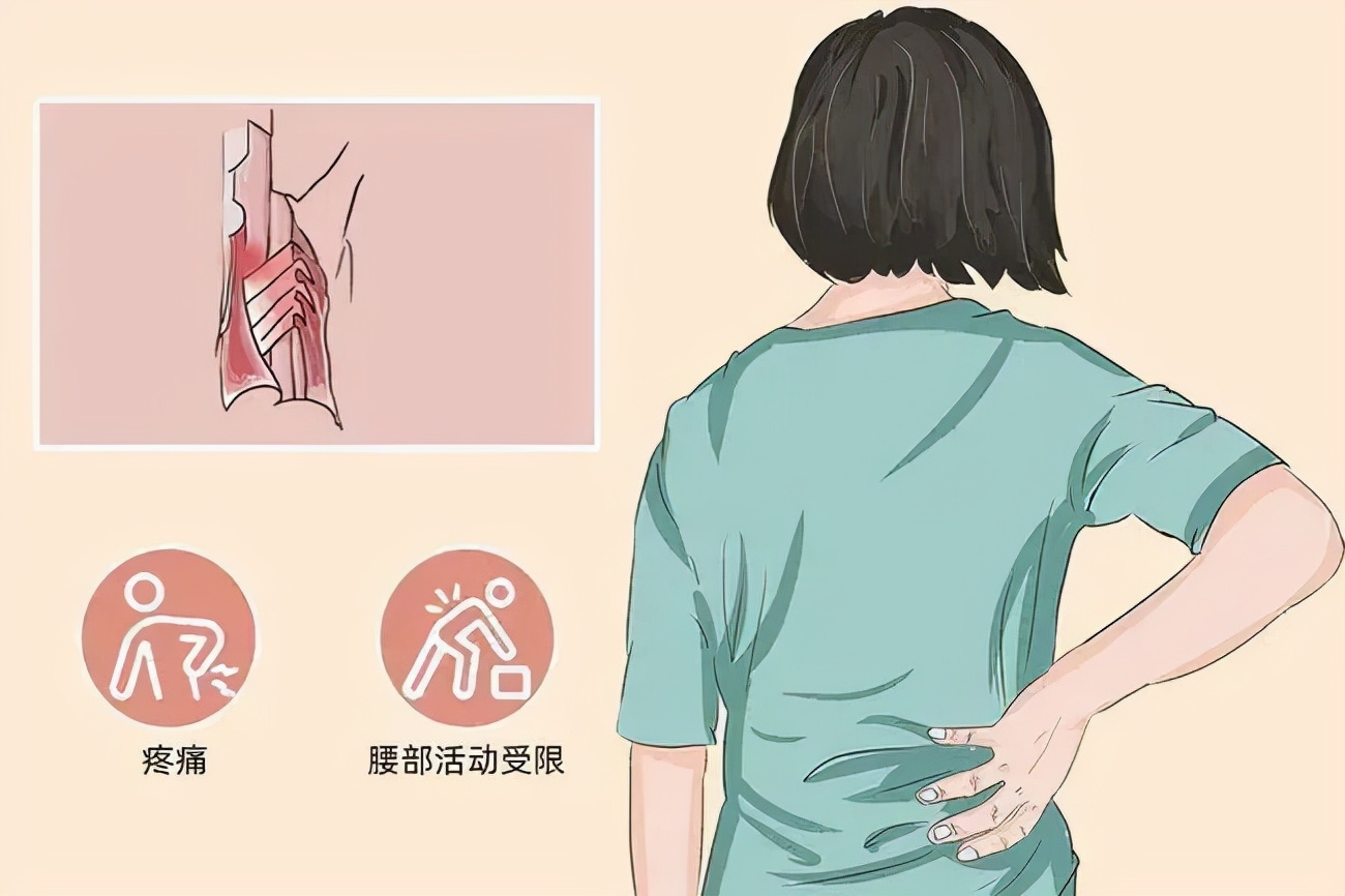 急性腰扭伤扎三针够不够,急性腰扭伤最快恢复穴位有几个