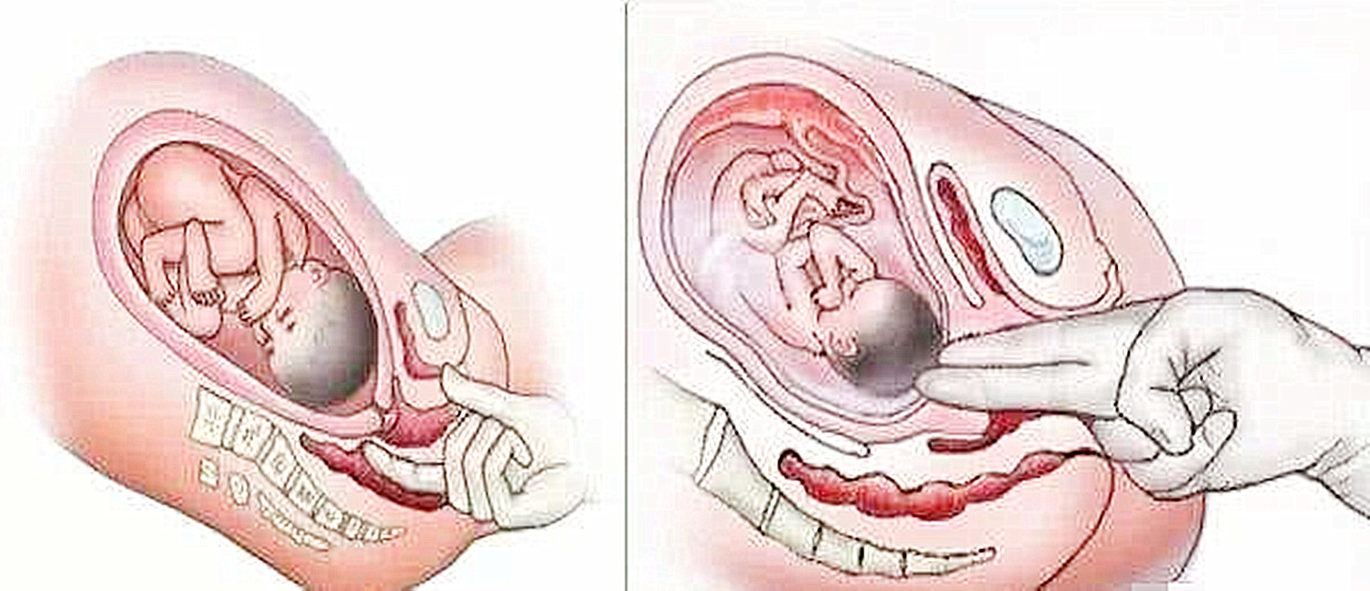 产前内检为什么那么痛,产前要内检疼吗