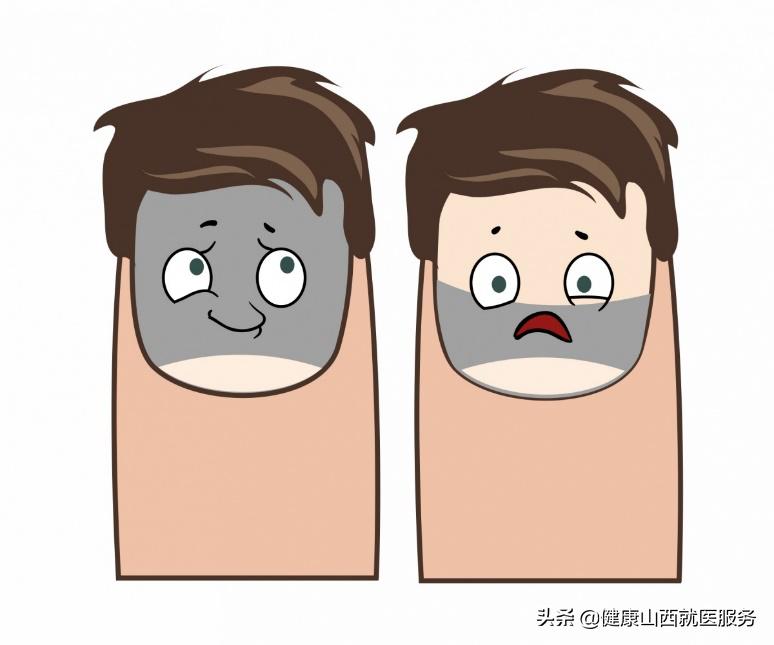 关于网上治疗灰指甲的谣言,白醋治灰指甲是谣言吗