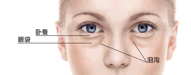 祛除眼袋的小妙招红霉素软膏,用什么可以祛除黑眼圈和眼袋