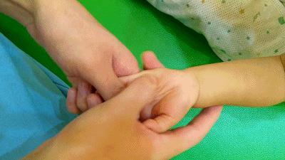 腺样体肥大怎么给孩子推拿,小儿腺样体肥大不手术会怎样