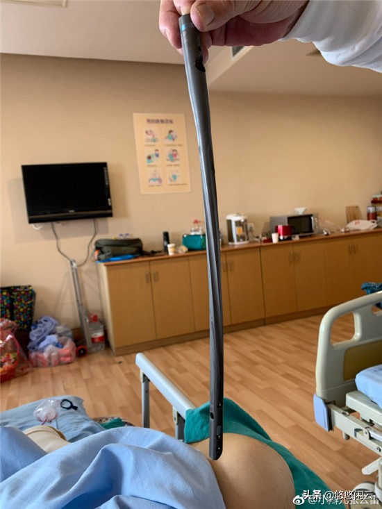 董九力说张云雷钢钉出来是哪一场,张云雷脚上钢钉露出时表演原视频