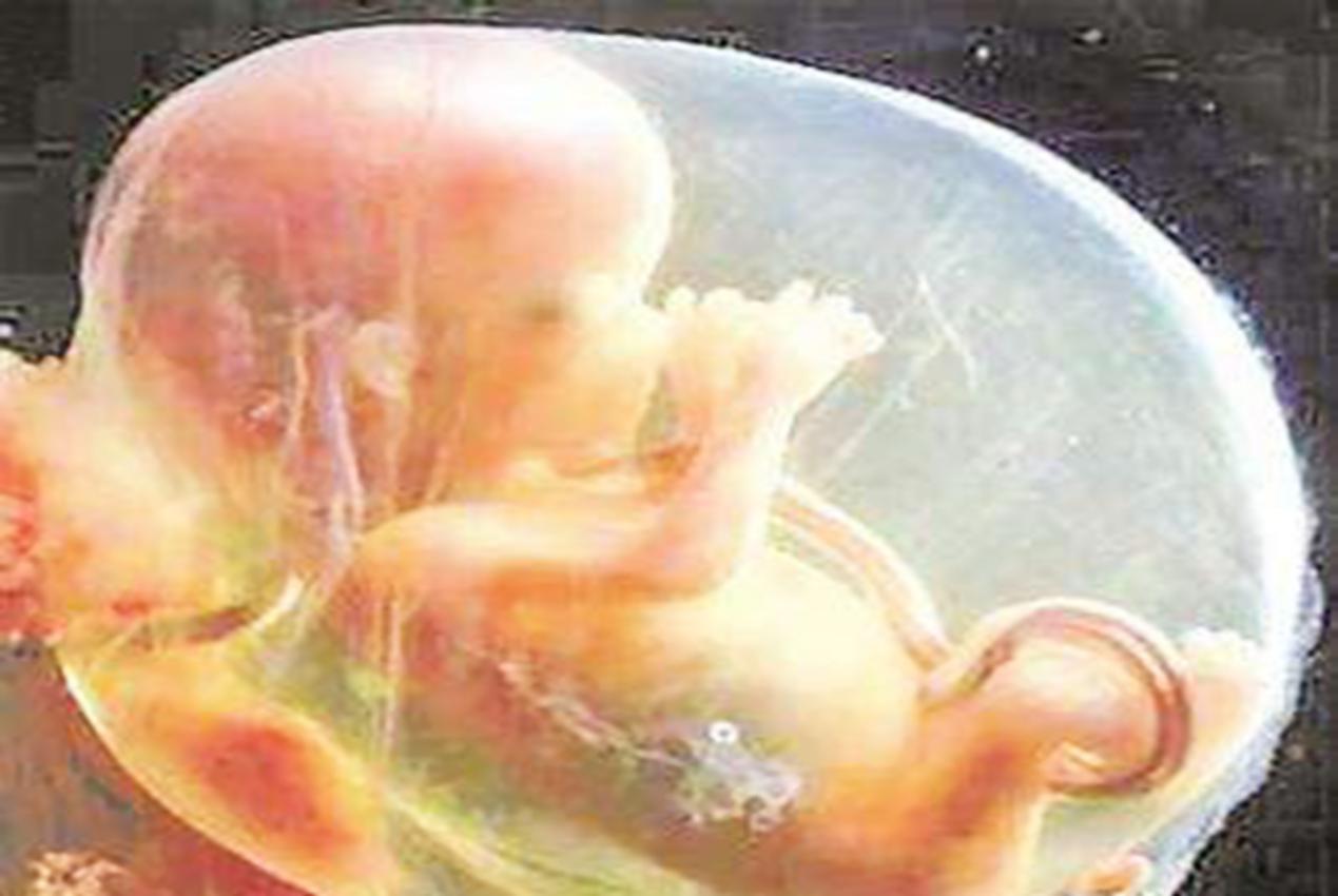 肚子发紧发硬是真宫缩还是假宫缩,肚皮发硬这是宫缩还是胎儿在拱背