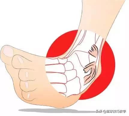 打球崴脚急救措施,打球崴脚了怎么高情商安慰