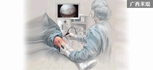 骨科专家教你护好关节,骨科专家孙好一招缓解关节损伤