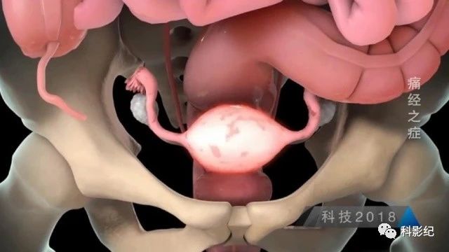 什么原因会引起痛经,痛经喝红糖水真的有用吗