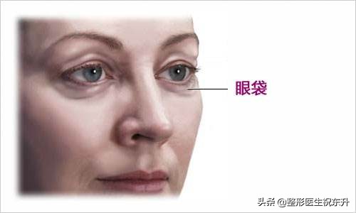 有眼袋泪沟化妆画卧蚕好看吗,泪沟跟卧蚕跟眼袋怎么区分