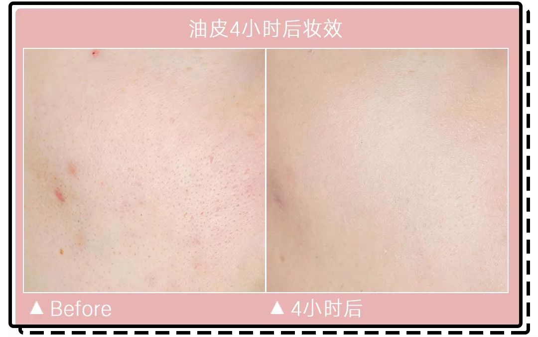 十大公认好用的混油皮粉底液排名,珀莱雅粉底液适合干皮还是油皮