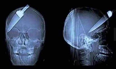 不作死就不会死看看你中了几条,不作死就不会死让人看的头皮发麻