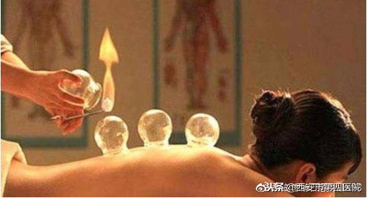 拔火罐的历史故事,拔火罐的真相揭秘