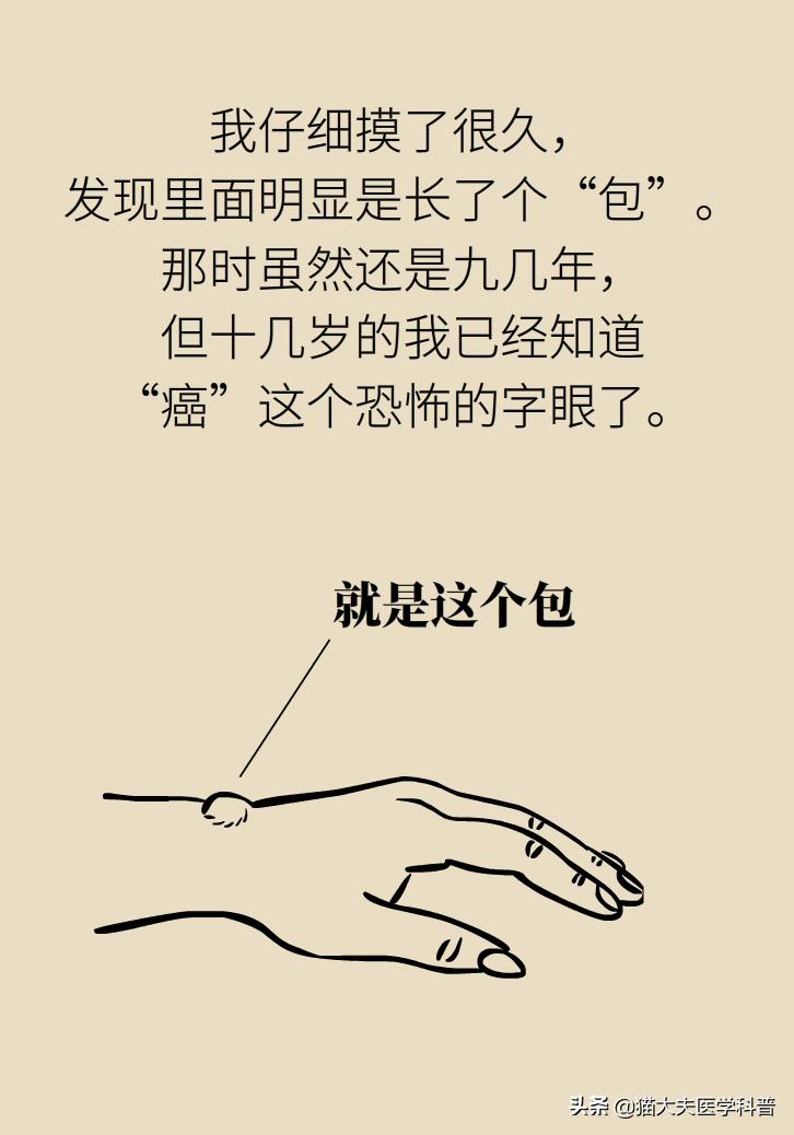 手腕长腱鞘囊肿,手腕上有个凸起的包腱鞘囊肿