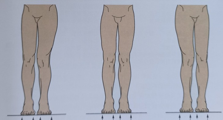 怎么练成瘦肌肉腿,结实大腿怎么减最快瘦下来