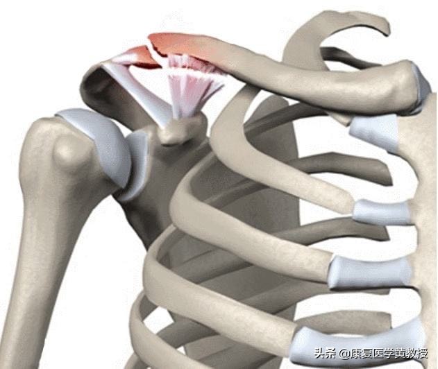 黄教授讲脑梗,中风后遗症肩痛的康复治疗