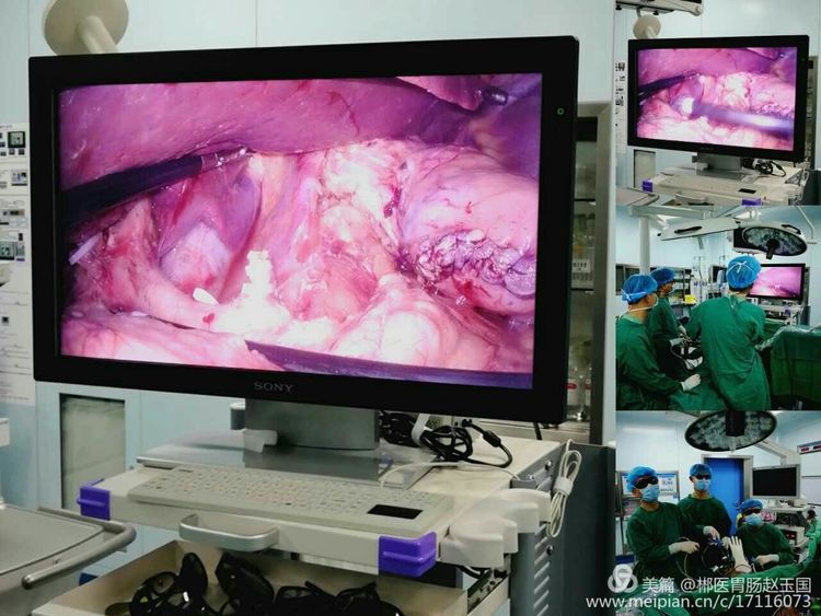 肥胖引起的糖尿病减肥后能治愈吗,肥胖减重手术知识问答