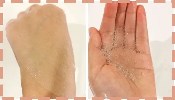 过敏长痘护肤品,一戴口罩脸过敏发痒发红怎么治