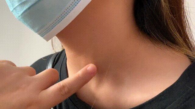 甲状腺结节偏方蒲公英,甲状腺结节4a类农村偏方