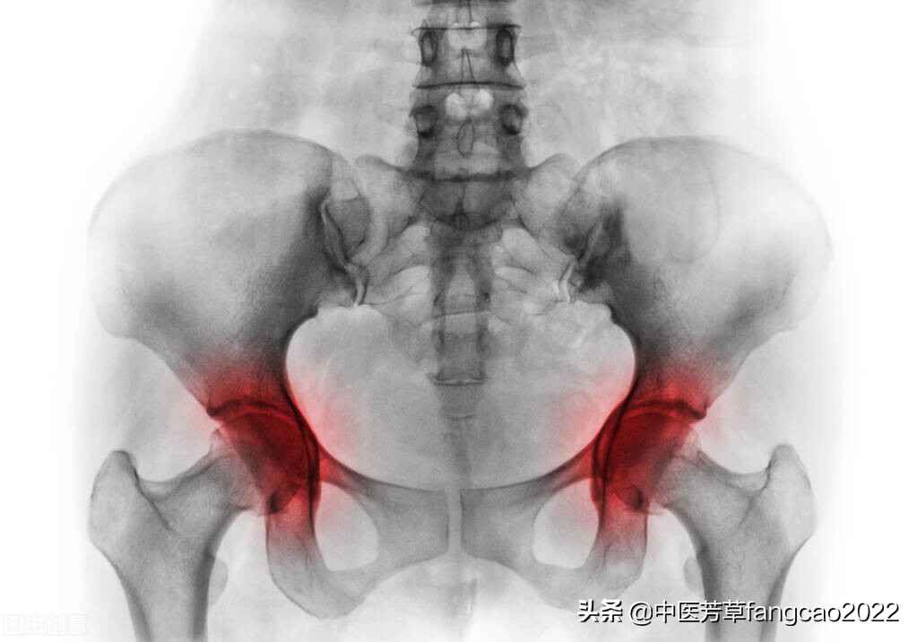 盆腔炎反复复发可以怀孕吗,急性盆腔炎反复发烧怎么办