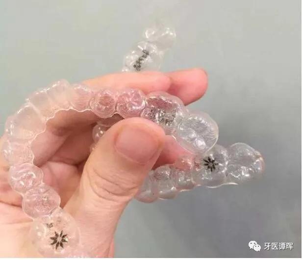 超详细的牙齿矫正过程,成人骨性牙齿矫正过程